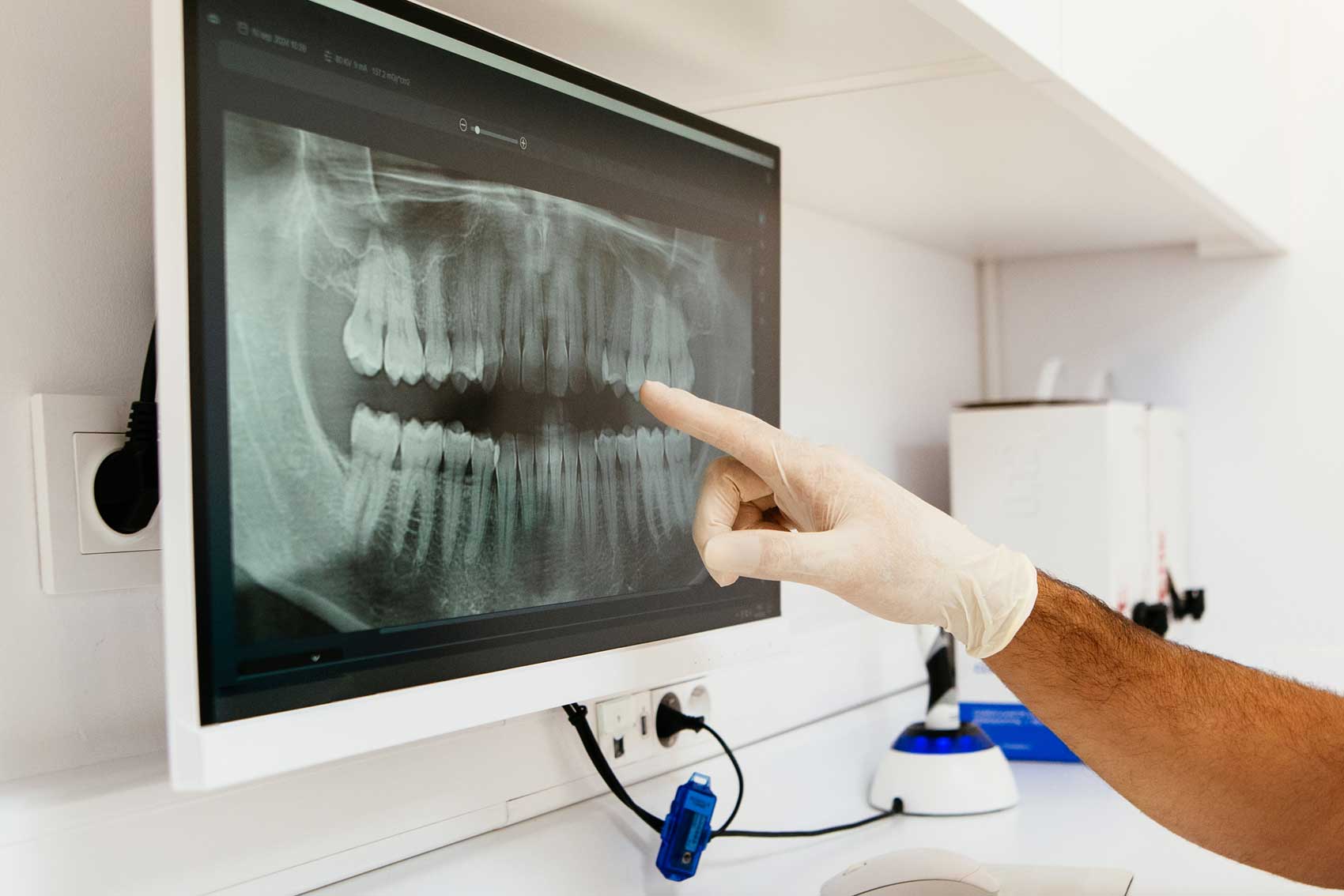 Dentist looking at x-ray to examine teeth and jaw-bone